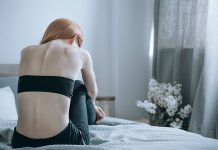 anorexia nervosa